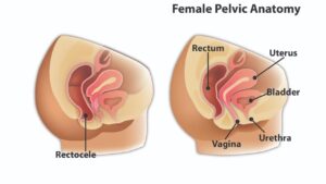 Female Pelvic Anatomy