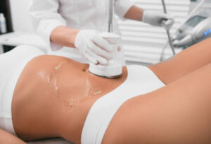 Image of woman undergoing laser Emsculpting treatment on stomach.